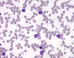 Marrow smear of healthy patient